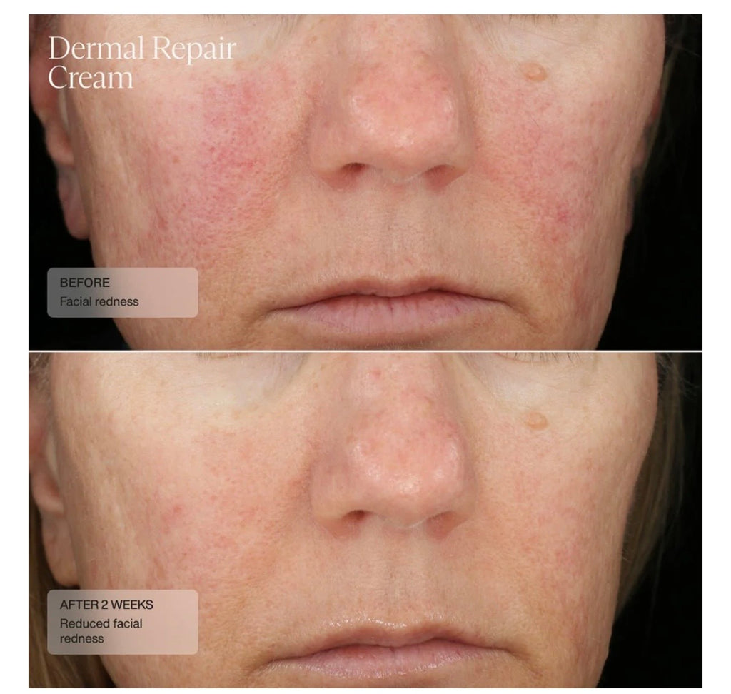 Sente Dermal Repair Cream