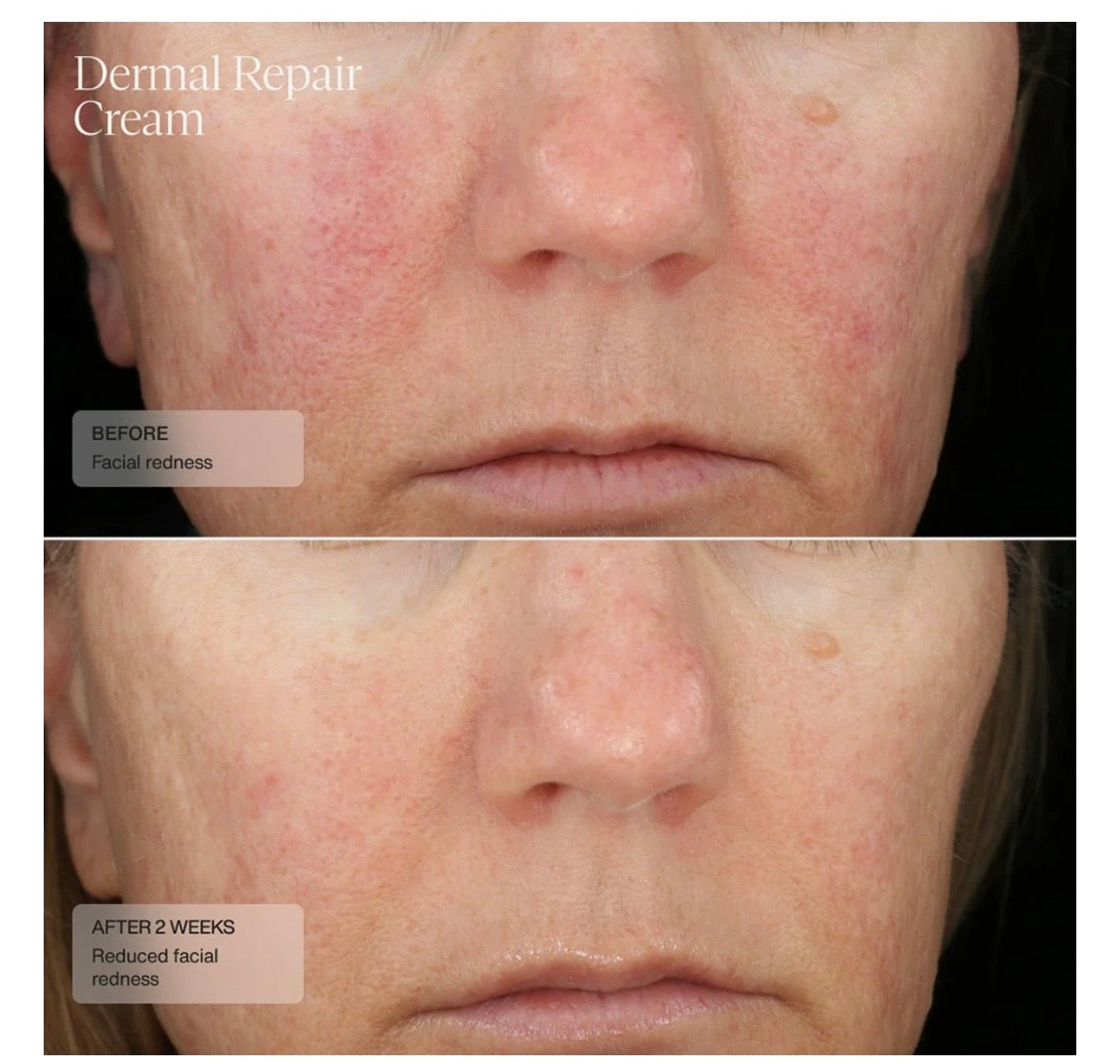 Sente Dermal Repair Cream